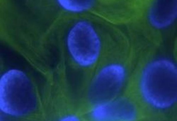 Каждая пятая женщина в Турции болеет раком молочной железы