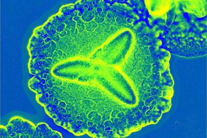 Гангрена лечит рак?