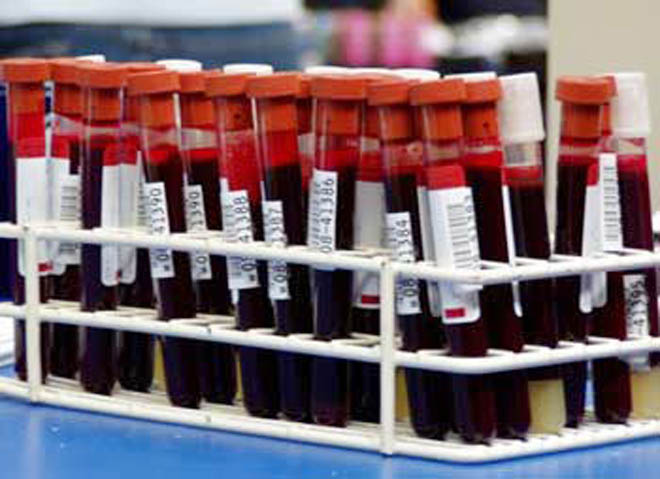 В Азербайджане один курс лечения от гепатита С на тяжелой стадии обходится в более чем 10 тысяч манатов - Джамиля Джаррахова