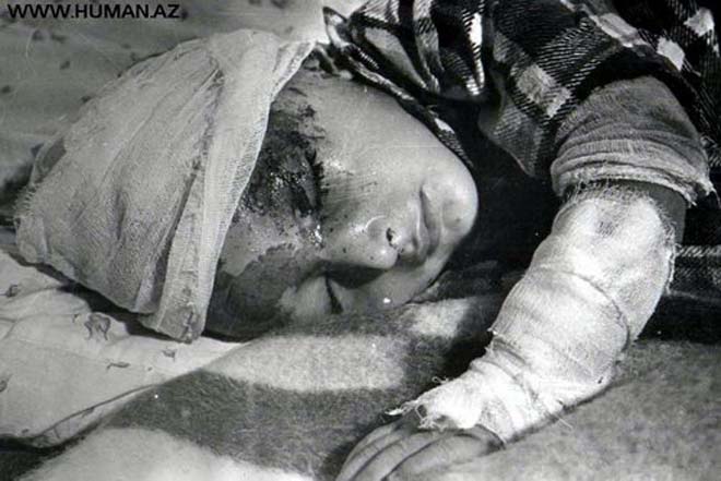 "Ходжалы – геноцид   XX   века"