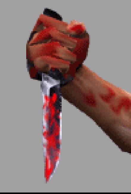 В Санкт-Петербурге ревнивый азербайджанец порезал свою девушку и соперника из Узбекистана