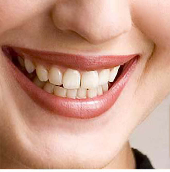 Йогурт и сок вредны для зубов