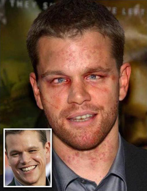 Кошмарные звезды (фотосессия)