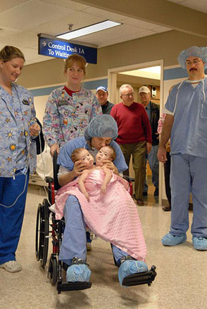 Американские сиамские близнецы – до и после (фотосессия)