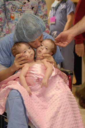 Американские сиамские близнецы – до и после (фотосессия)