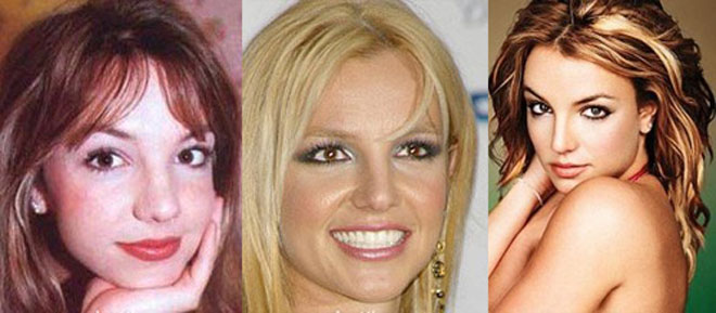 9 лучших исправленных звездных носов (фотосессия)