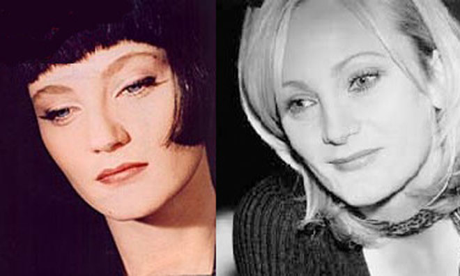 9 лучших исправленных звездных носов (фотосессия)