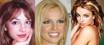 9 лучших исправленных звездных носов (фотосессия)