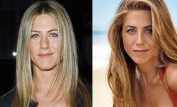 9 лучших исправленных звездных носов (фотосессия)