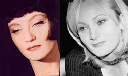 9 лучших исправленных звездных носов (фотосессия)