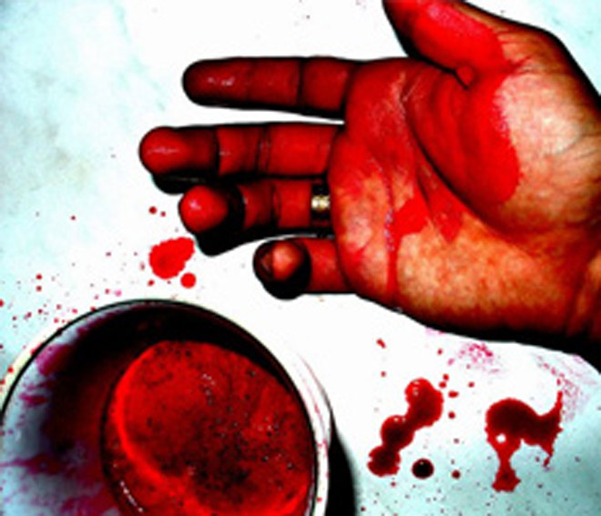 В Челябинске сын депутата Милли Меджлиса Азербайджана Ильяса Исмайлова пытался вскрыть себе вены