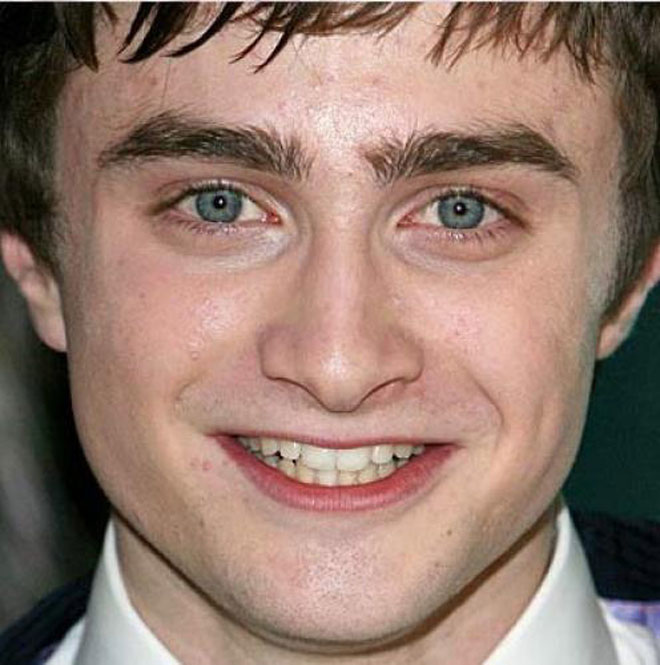 Худшие улыбки голливудских звезд (фотосессия)