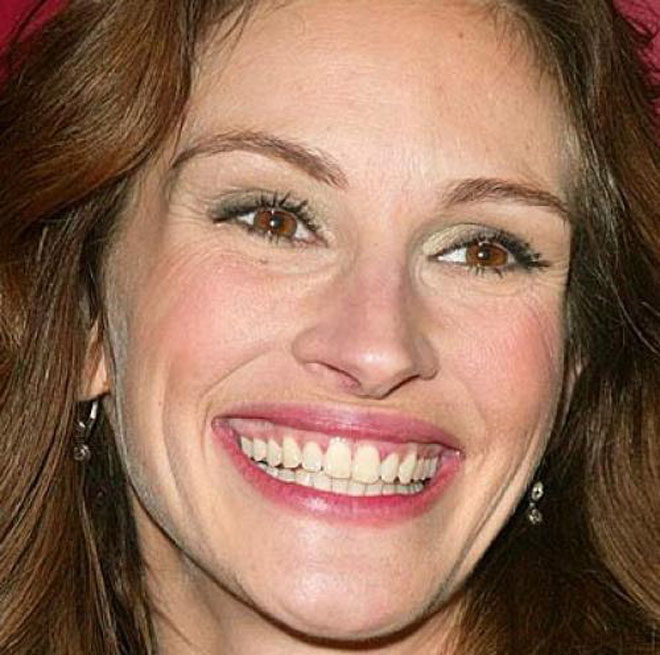 Худшие улыбки голливудских звезд (фотосессия)