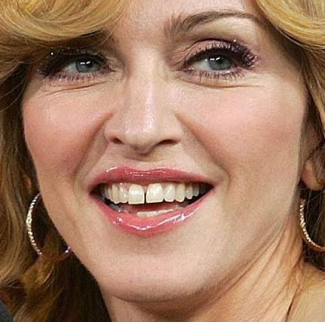 Худшие улыбки голливудских звезд (фотосессия)