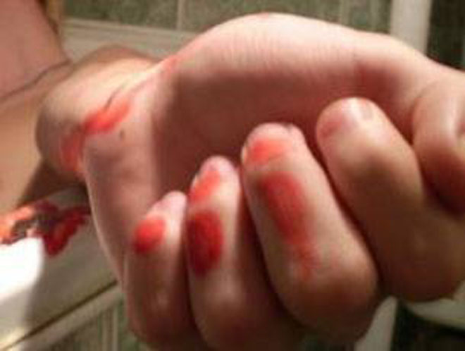 Семьи наркоманов и алкоголиков - фактор суицидального риска детей - МВД Азербайджана