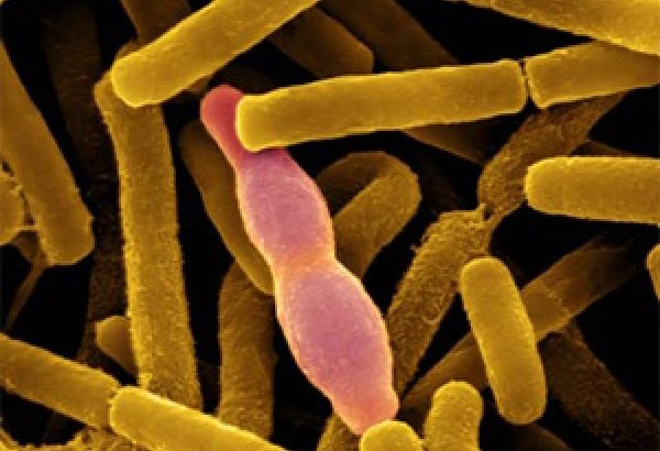 На севере Казахстана мужчина умер от сибирской язвы