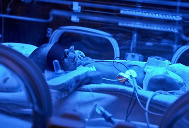 Самая маленькая мама в мире родила сына (фотосессия)