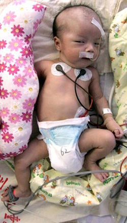 В Китае 9-летняя девочка родила здорового малыша