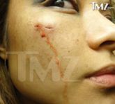 Тилу Текилу жестоко избили