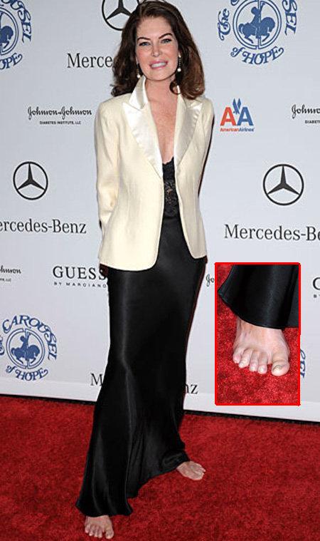 Звёзды с самыми некрасивыми ногами (фотосессия)