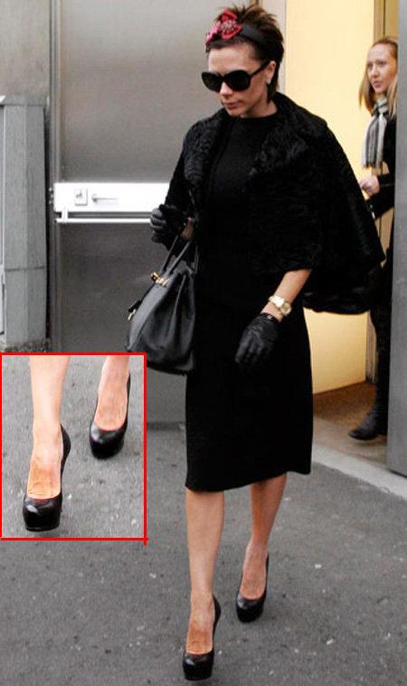 Звёзды с самыми некрасивыми ногами (фотосессия)