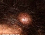 Аль Пачино шокировал публику нарывом на голове (фотосессия)