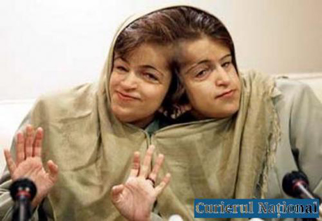 Люди с редкими заболеваниями (фотосессия)