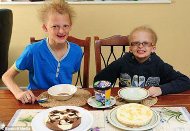 Люди с редкими заболеваниями (фотосессия)