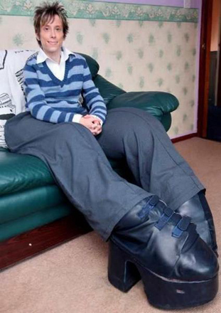 Люди с редкими заболеваниями (фотосессия)