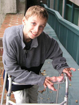 Люди с редкими заболеваниями (фотосессия)