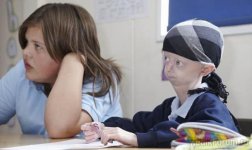 Люди с редкими заболеваниями (фотосессия)