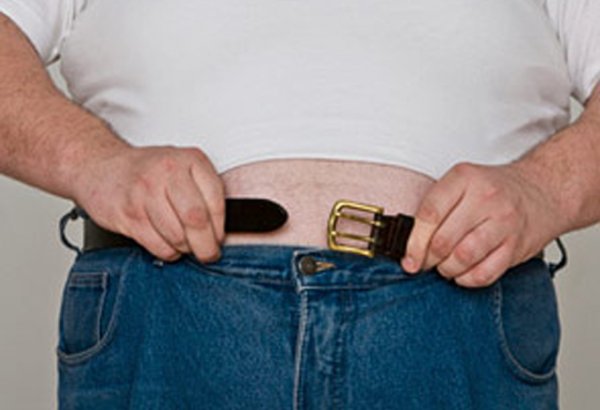 Ученые: ожирение на 30% повышает вероятность развития старческого слабоумия