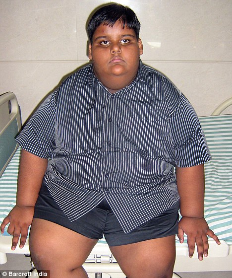 10-летнему мальчику сделали операцию по уменьшению желудка (фотосессия)