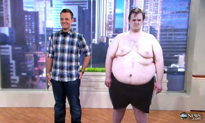 Американец похудел на 100 кг (фотосессия)