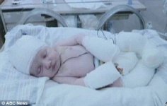 У ребенка на большей части тела нет кожи (фотосессия)
