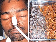 Врачи обнаружили в желудке пациента необычное содержимое