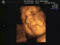 В чем особенность ультразвуковой диагностики 4D при беременности