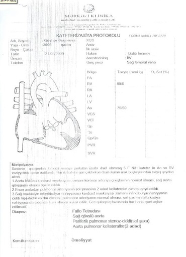 Порок сердца - брату и сестре Аскеровым необходима срочная помощь (фото, документы)