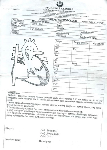 Порок сердца - брату и сестре Аскеровым необходима срочная помощь (фото, документы)