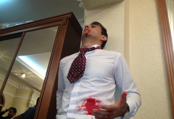 Руслан Сабирли рассказал о новом сериале "Верю в тебя": "В день своей свадьбы…" (фото)