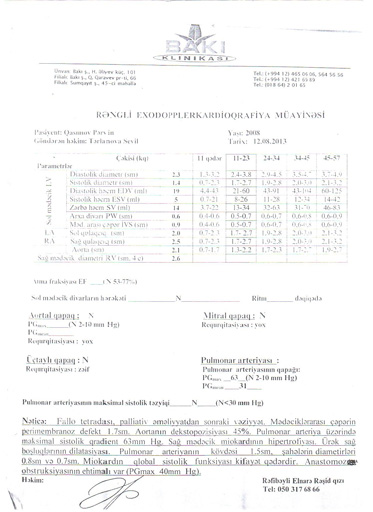 Пятилетнему Пярвину Гасымову требуется помощь: срочно необходима операция (фото)