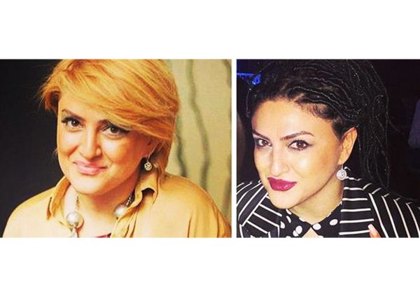 Новый образ участницы проекта "Голос" Айгюн Аскеровой (ФОТО)