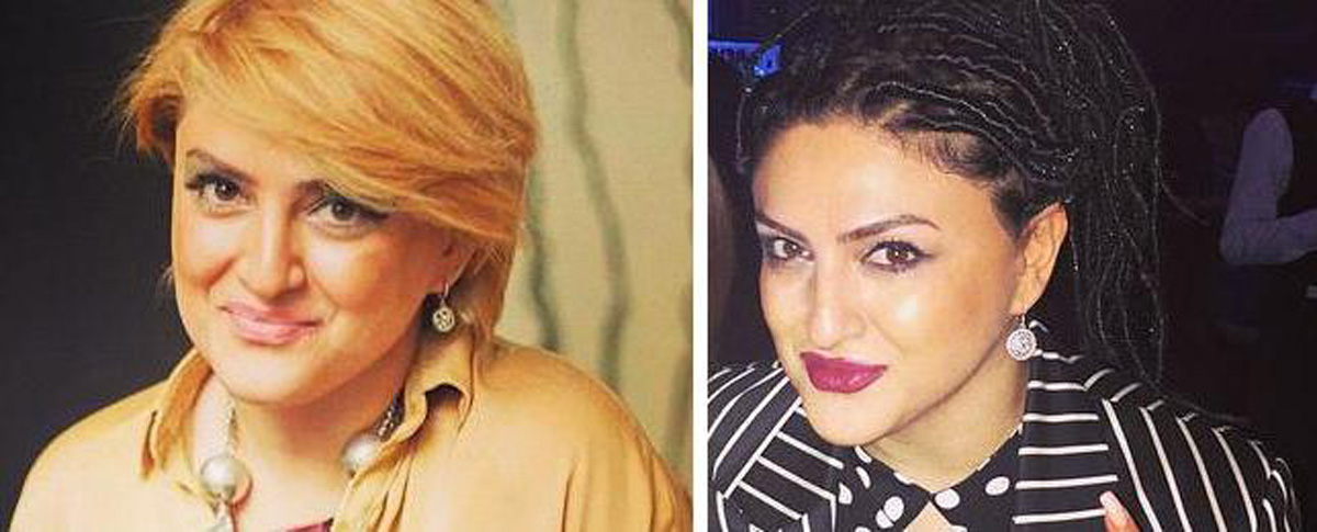 Новый образ участницы проекта "Голос" Айгюн Аскеровой (ФОТО)