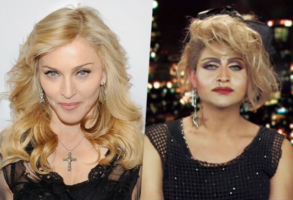 Поклонники, сделавшие пластику ради сходства с кумирами (ФОТО)