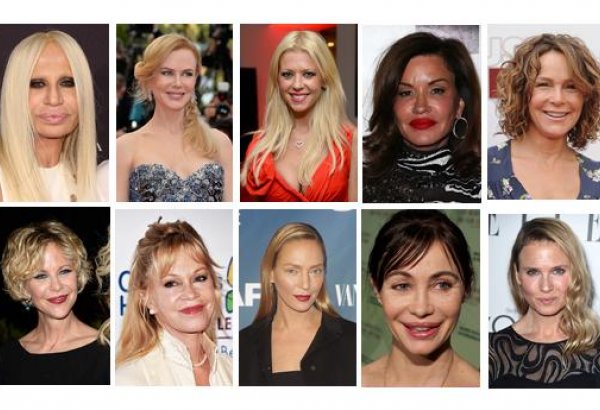 Неудачные пластические операции звезд (ФОТО)