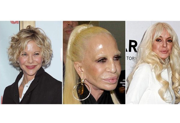 Знаменитости, растерявшие свою красоту (ФОТО)