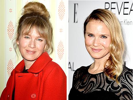 Актриса Рене Зеллвегер вернула себе прежнее лицо (ФОТО)