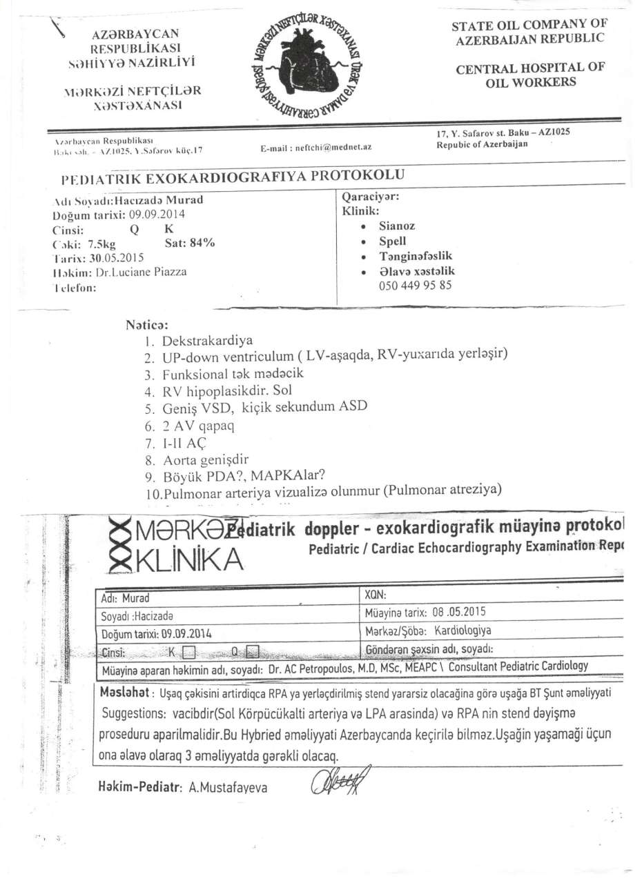 Двухлетнему Мураду необходима срочная помощь (ФОТО, ДОКУМЕНТЫ)