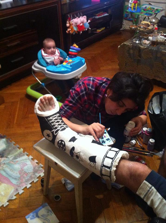 Нога в гипсе Эльнура Керимова стала креативным произведением (ФОТО)