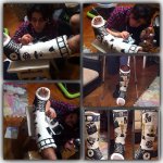 Нога в гипсе Эльнура Керимова стала креативным произведением (ФОТО)